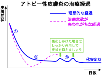 アトピー性皮膚炎の治療経過グラフ